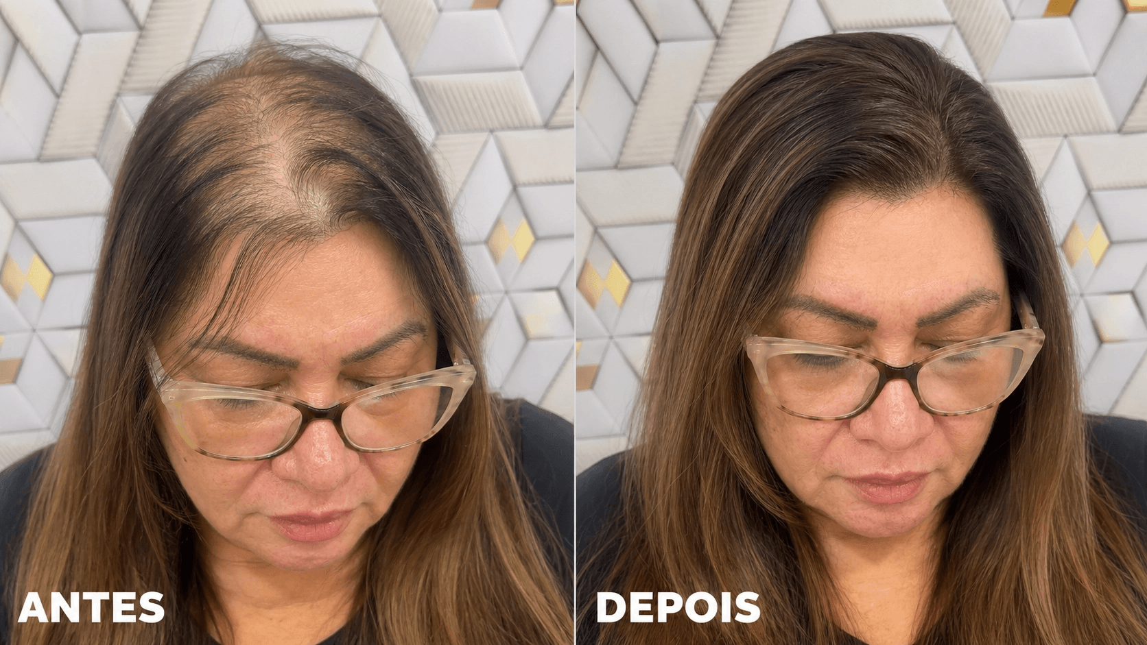 cida antes e depois ot